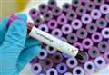 Significant drop in covid tests taken