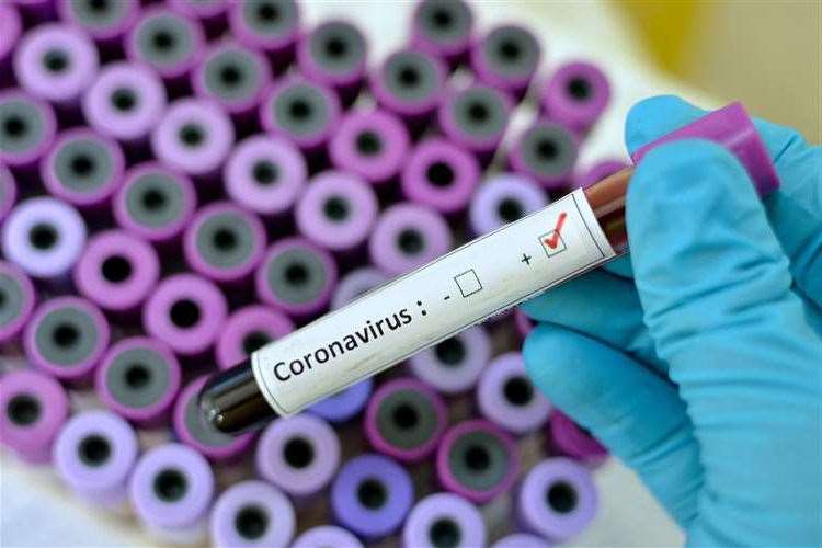 Coronavirus (33497535)