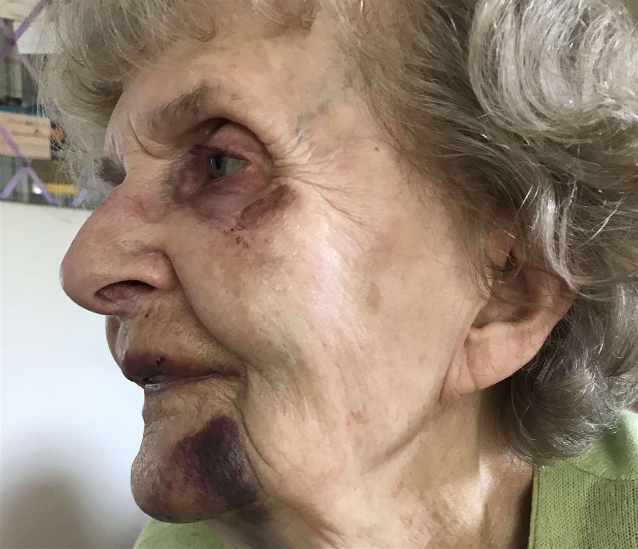 Dorothy Alexander, who was one of the residents who has recently tripped on uneven pavement in Stamford (17830987)