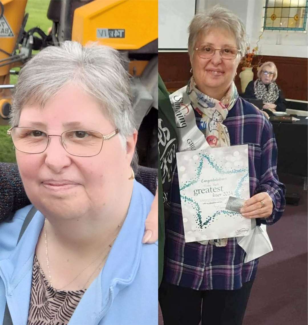 Before and after picture