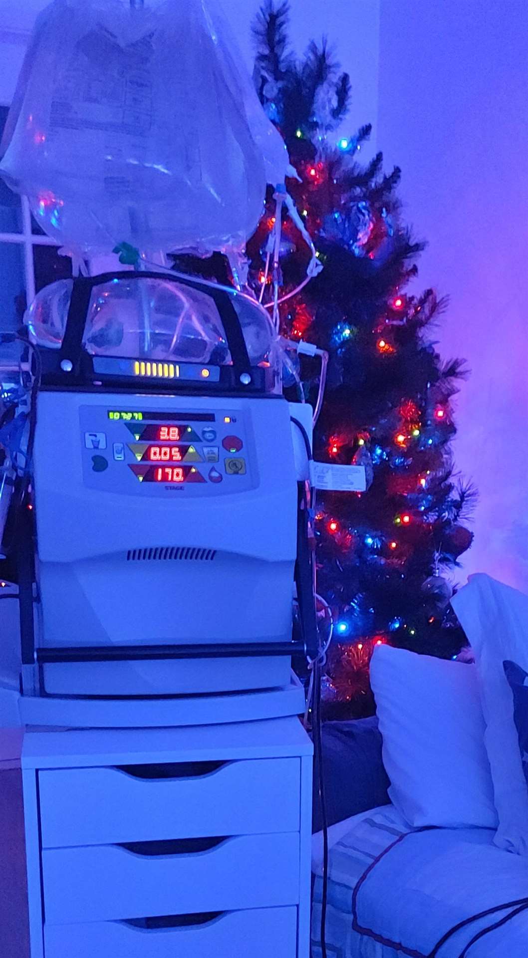 Charlie requires dialysis throughout the night