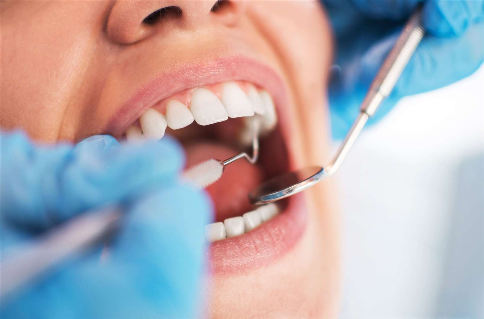 Just 25% of the people living in Lincolnshire have access to a dentist Picture:iStock